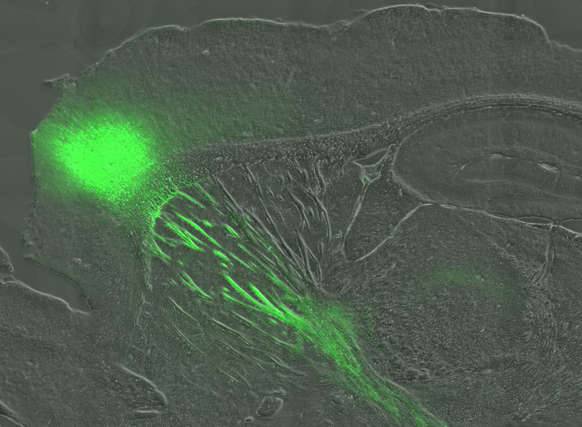 Administrando el gen de las opsinas (en verde) a la corteza cerebral, se pueden activar de forma selectiva las terminales neuronales en el núcleo estriado, que expresan la proteína. Esta estimulación ha permitido mejorar los síntomas en el modelo experimental de la enfermedad de Huntington (imagen: Sara Conde Berriozabal)