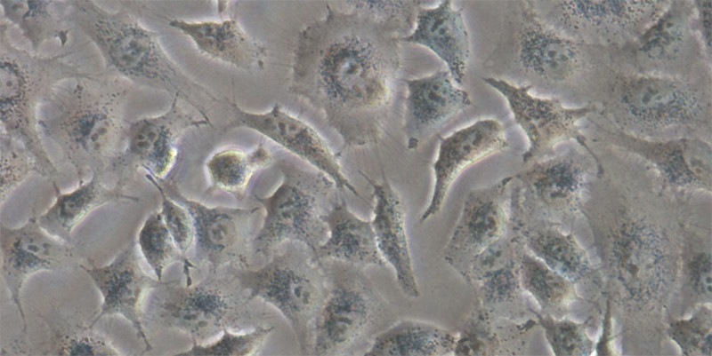 Cèl·lules d’adenocarcinoma de pulmó humà utilitzades a l’estudi. / Daniel Carbajo
