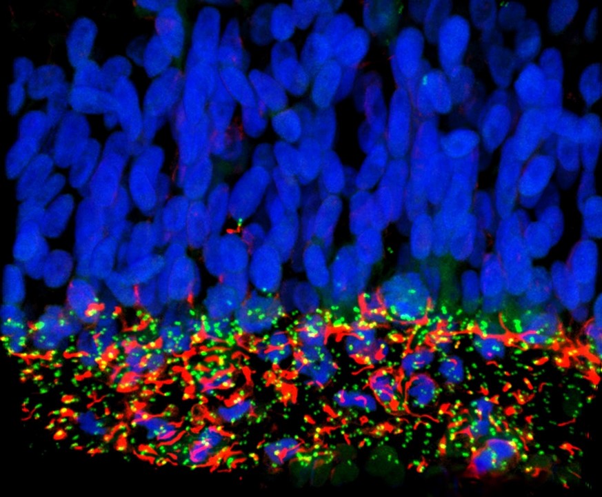 La il·lustració representa les cèl·lules mare neurals en un embrió (en blau). Els cilis primaris, marcats en vermell, i les proteïnes de la base del cili (en verd) es veuen afectats per la proteïna NS5 de virus Zika, el que desencadena la interrupció del creixement del cervell.