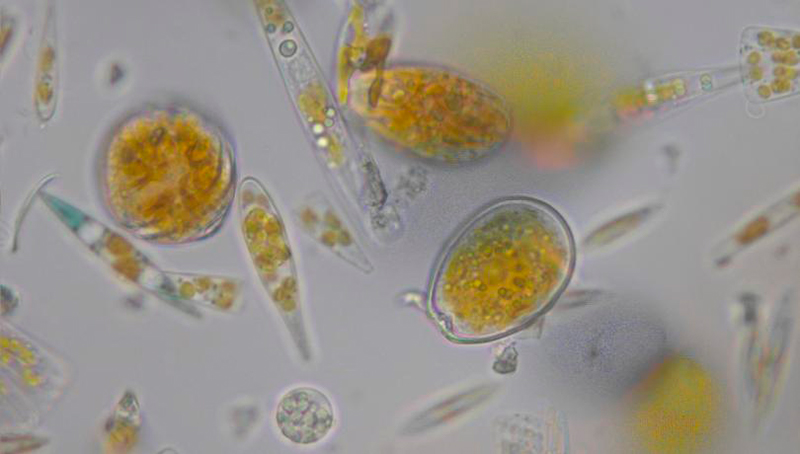 Mostres costaneres de plàncton vistes al microscopi / Albert Reñé (ICM-CSIC)