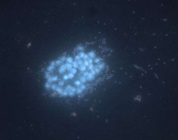 Bacterias sin identificar (CEAB-CSIC).
