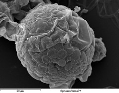 Un microorganisme en què han trobat microARN animal sense ser ell mateix animal és Sphaeoforma Arctica (a la imatge). Ha estat aïllat de l'estómac d'un petit crustaci de l'Àrtic (Gammarus setosus), però ningú sap encara si es tracta d'un paràsit o si el crustaci s'ho havia menjat 