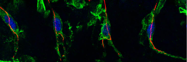 Cèl·lules traqueals de Drosophila. Imatge: Sofia J. Araujo.