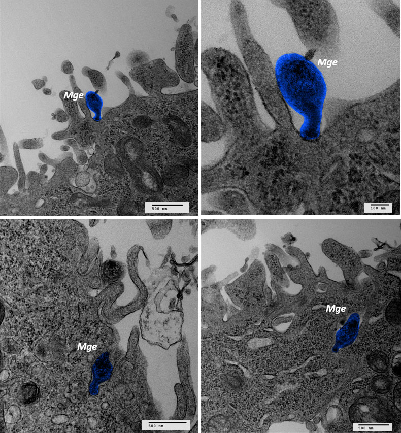 Imatges de microscòpia electrònica de transmissió, on s’observa el bacteri Mycoplasma genitalium (Mge) adherit a la superfície d’una cèl•lula humana (imatges superiors) i penetrant a l’interior d’aquestes cèl•lules (imatges inferiors). La imatge ha estat editada per facilitar la identificació del micoplasma (acolorit en blau).