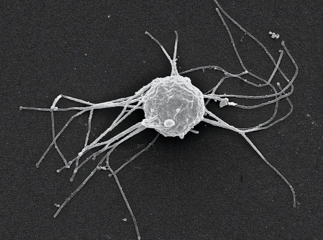 Una imatge de Ministeria vibrans, un dels organismes estudiats (Iñaki Ruiz-Trillo / Multicellgenome Lab)