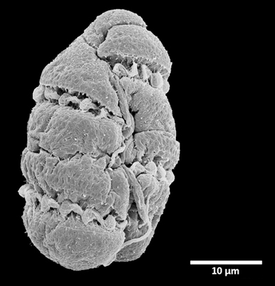 Imatge de microscopia electrònica de rastreig de Polykrikos tanit (Albert Reñé/CSIC)