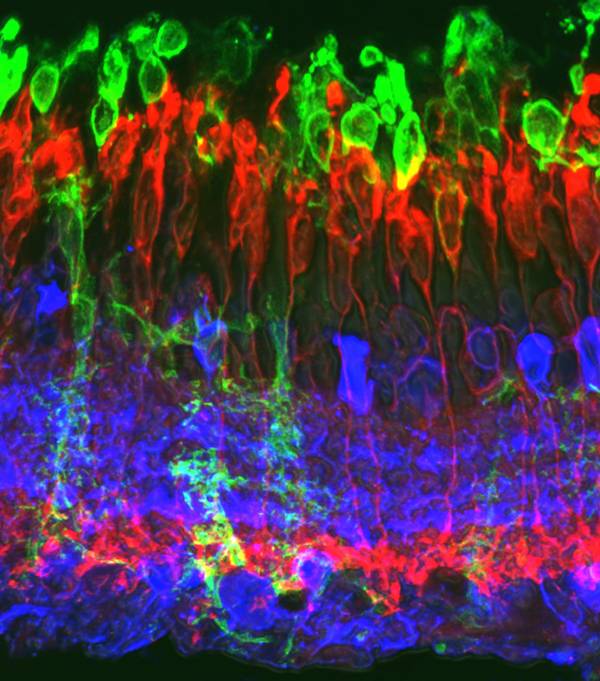 Imagen histológica de la retina de un animal rd10 al mes de edad, en la que se observa una alteración importante de la capa de los fotorreceptores de la retina (Cátedra Bidons Egara-UMH).