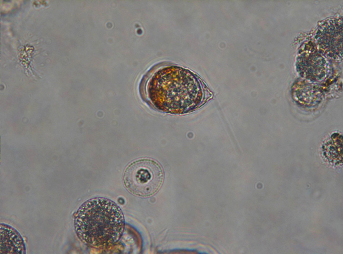 Microalgues Scrippsiella trochoidea, un dels hostes preferits, infectats pel paràsit. Imatge: ICM/CSIC.