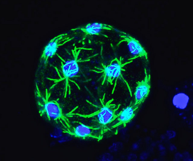 Sphaerophorma arctica, un dels microorganismes estudiats a l'Institut de Biología Evolutiva, CSIC-UPF. Imatge d'Iñaki Ruiz-Trillo/Multicellgenome Lab.