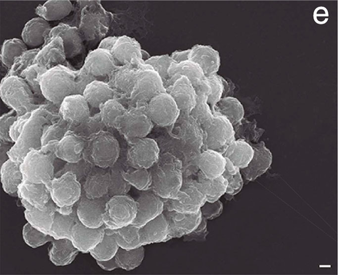Agregació d'amebas C. owczarzaki. Imagen: Arnau Sebé-Pedrós
