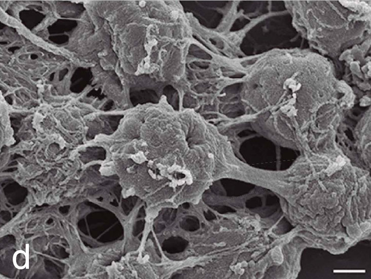 Amebas C. owczarzaki uniéndose unas con otras. Imagen: Arnau Sebé-Pedrós. 