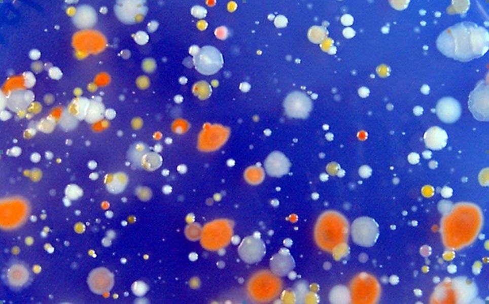 Bacteris aïllats del Mediterrani, molts d’ells amb proteorodopsina. Imatge: Laura Gómez/ICM-CSIC
