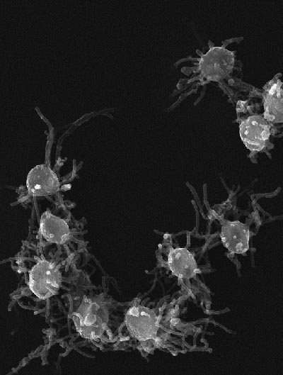 L'ameba Capsaspora owczarzaki, aïllada de la hemolimfa d'un cargol de Puerto Rico. Imatge: Multicellgenomelab.