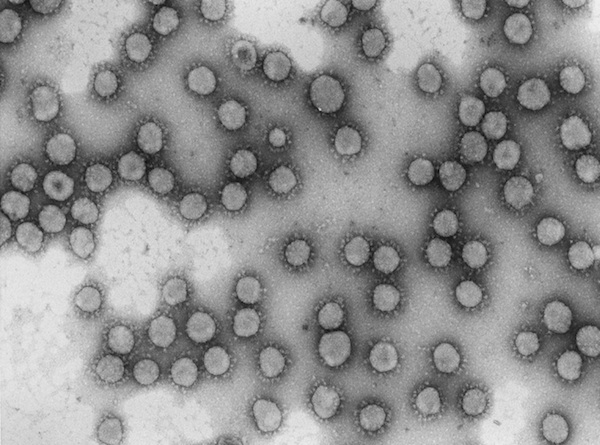 Imagen del coronavirus (Luis Enjunes. CNB-CSIC)