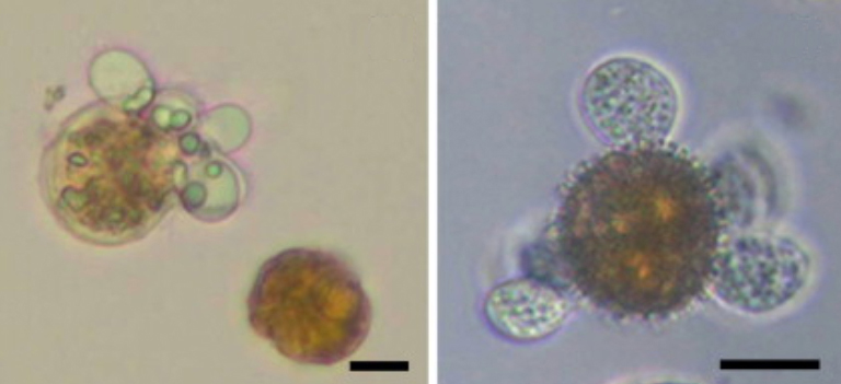 El hongo Dinomyces Arenysensis infectando diferentes microalgas. Imagen: Elisabet Alacid / ICM-CSIC  