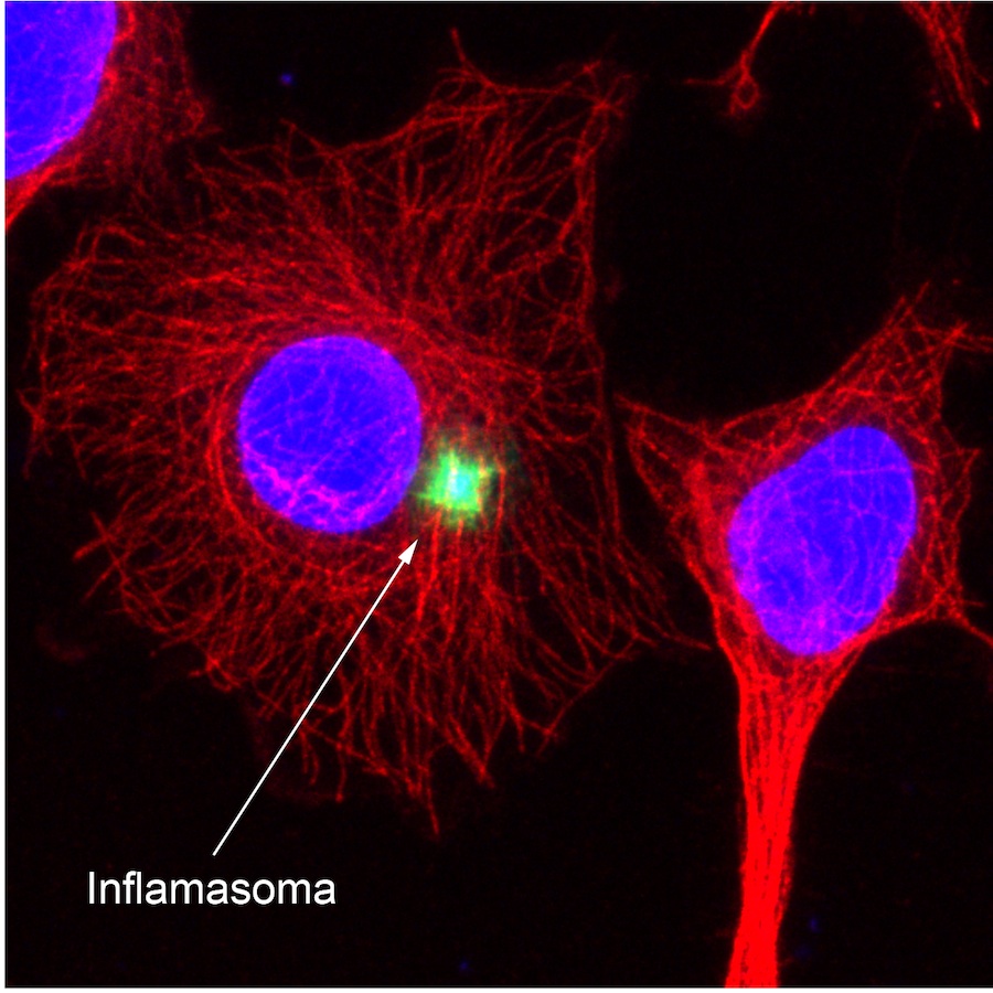 L'inflamosoma en una cèl·lula, senyalitzat per fluorescència (Imatge: Maria Miquel / IBMB-CSIC).