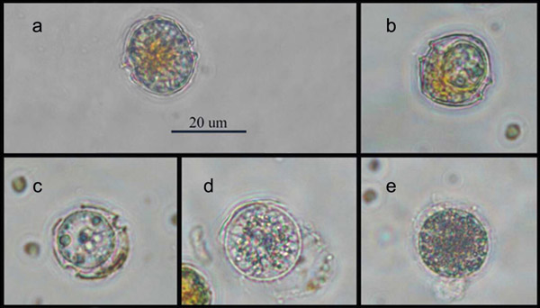 Procés d'infecció d'una alga dinoflagel•lada per part del paràsit. a, cèl•lula hoste sana; b-c, desenvolupament del paràsit a l'interior de l'hoste; d-e, el paràsit ha matat el seu hoste i ha format un esporangi (que conté les espores, les quals un cop actives abandonaran aquesta estructura per anar a infectar nous hostes). Imagen: ICM/CSIC