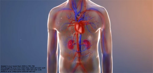 La malaltia de Fabry causa danys a diversos òrgans, i pot provocar fallada renal i problemes al cor. Imatge d'un video que es pot veure a http://smart4fabry.eu/impact-of-fabry-disease-on-the-heart-kidneys/ 