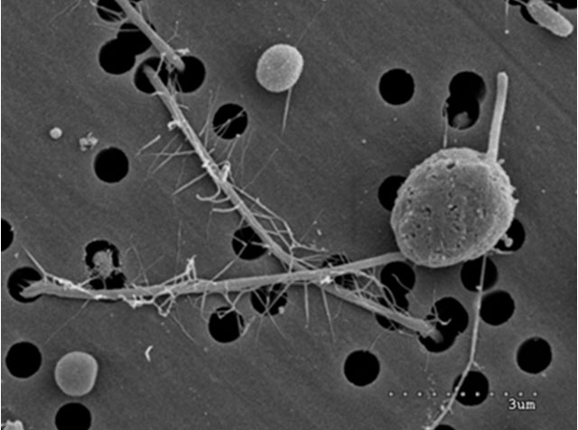 Imatge d’un paràsit feta amb microscopia electrònica de rastreig. El paràsit té dos flagells diferents, un de llarg i pelut, i l’altre, curt i llis. Foto d’ Esther Garcés. 