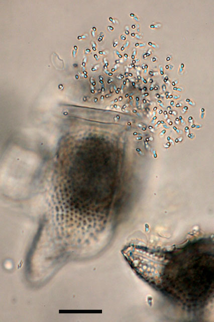 Imatge de microscopia òptica on es mostra els paràsits sortint de l’esporangi que han format dins de l'hoste, en aquest cas la microalga Dinophysis caudata (amb forma de copa), per la cerca de nous hostes a qui infectar. La barra d’escala és de 10µm. Foto d’ Isabel Bravo.